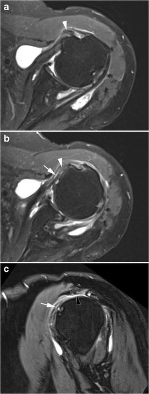 https://cdn.ncbi.nlm.nih.gov/pmc/blobs/1270/5110480/2ccdf387ce84/13244_2016_526_Fig11_HTML.jpg