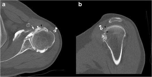https://cdn.ncbi.nlm.nih.gov/pmc/blobs/1270/5110480/381119a0d3ae/13244_2016_526_Fig7_HTML.jpg