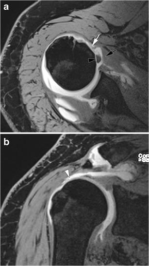 https://cdn.ncbi.nlm.nih.gov/pmc/blobs/1270/5110480/9e8f742c764a/13244_2016_526_Fig9_HTML.jpg