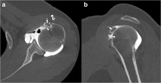 https://cdn.ncbi.nlm.nih.gov/pmc/blobs/1270/5110480/cfec11323c52/13244_2016_526_Fig6_HTML.jpg