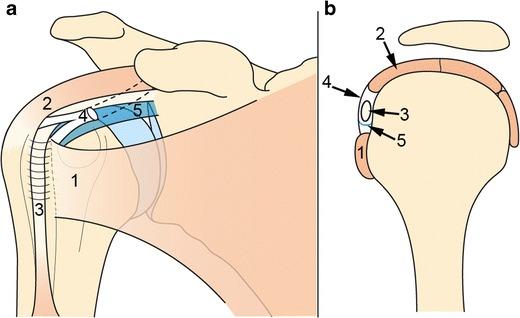 https://cdn.ncbi.nlm.nih.gov/pmc/blobs/1270/5110480/d4c40c4d3570/13244_2016_526_Fig2_HTML.jpg