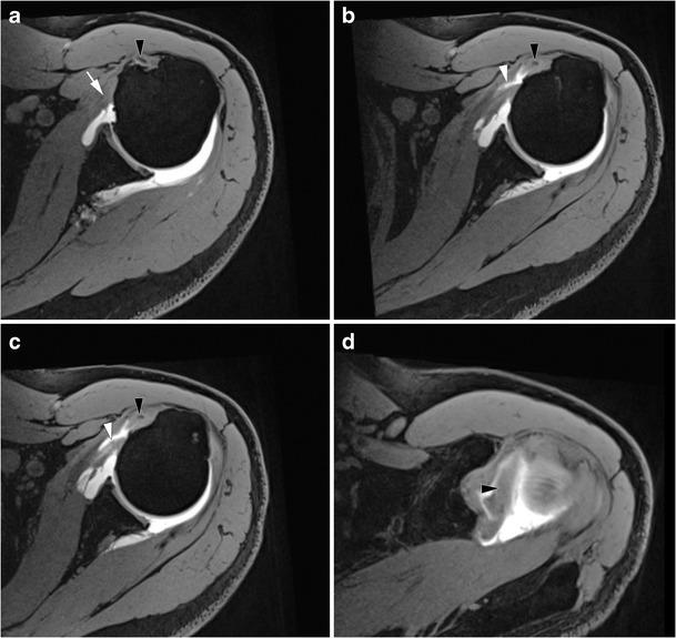 https://cdn.ncbi.nlm.nih.gov/pmc/blobs/1270/5110480/d9e386b07c7f/13244_2016_526_Fig10_HTML.jpg