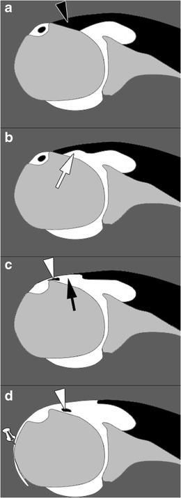 https://cdn.ncbi.nlm.nih.gov/pmc/blobs/1270/5110480/df4fef1e73a6/13244_2016_526_Fig5_HTML.jpg