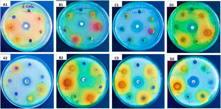 https://cdn.ncbi.nlm.nih.gov/pmc/blobs/1272/9087274/bec2299c0bf1/10.1177_15593258221098992-fig8.jpg