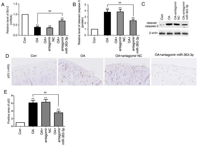 https://cdn.ncbi.nlm.nih.gov/pmc/blobs/1277/7003040/f36380cd8ebf/MMR-21-03-1077-g06.jpg