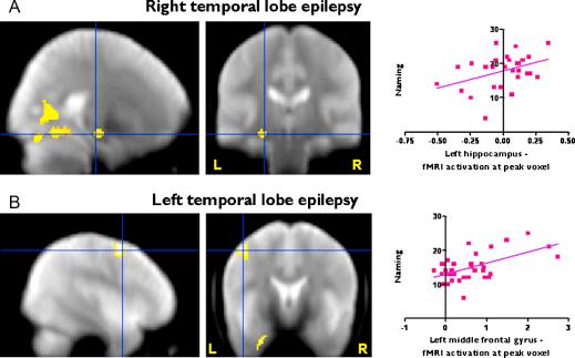 https://cdn.ncbi.nlm.nih.gov/pmc/blobs/1278/3229979/8aef67afbfe2/gr2.jpg