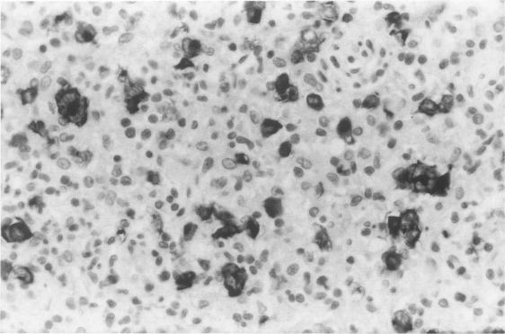 https://cdn.ncbi.nlm.nih.gov/pmc/blobs/127d/1886437/2b6058e09930/amjpathol00086-0011-a.jpg
