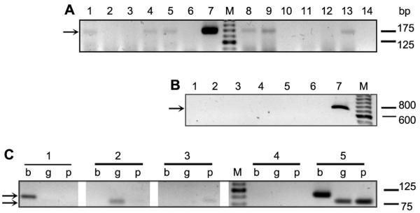 https://cdn.ncbi.nlm.nih.gov/pmc/blobs/127d/3449195/7fbd93002ca9/1471-2334-12-191-2.jpg