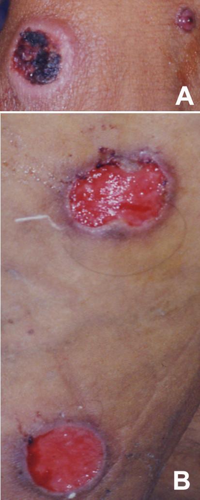 https://cdn.ncbi.nlm.nih.gov/pmc/blobs/127d/3449195/f4e5e1eda505/1471-2334-12-191-1.jpg