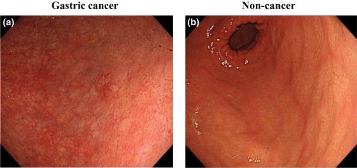 https://cdn.ncbi.nlm.nih.gov/pmc/blobs/1281/7818187/7372baf04fb0/DEN-33-141-g002.jpg