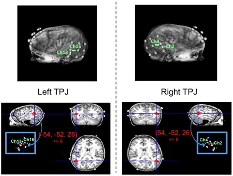 https://cdn.ncbi.nlm.nih.gov/pmc/blobs/1283/4595792/4e2b816c75e4/fnhum-09-00560-g003.jpg