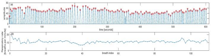https://cdn.ncbi.nlm.nih.gov/pmc/blobs/1286/6264115/3abe3f60288d/sensors-18-03705-g006.jpg