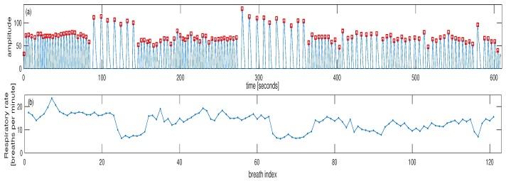 https://cdn.ncbi.nlm.nih.gov/pmc/blobs/1286/6264115/b3a95d85f2fc/sensors-18-03705-g005.jpg