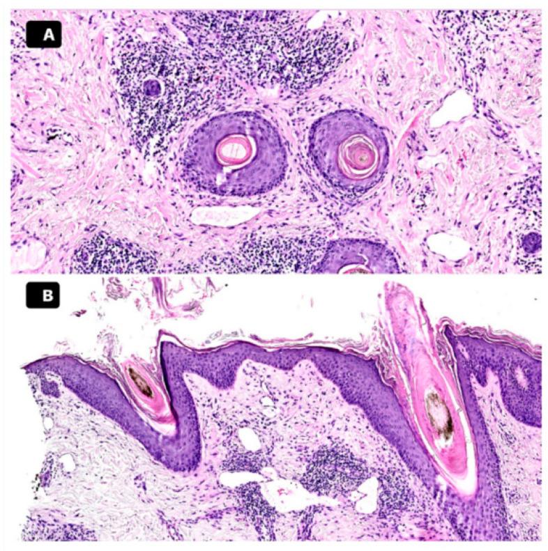 https://cdn.ncbi.nlm.nih.gov/pmc/blobs/1288/11596965/b4ef6cb1a9e7/medicina-60-01839-g002.jpg