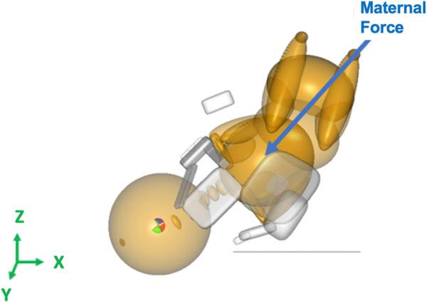 https://cdn.ncbi.nlm.nih.gov/pmc/blobs/128a/12078281/c03f8b62bfb8/fbioe-13-1474154-g002.jpg