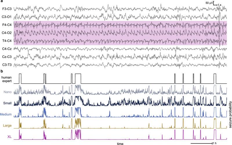https://cdn.ncbi.nlm.nih.gov/pmc/blobs/128c/11711471/adfcfba3203e/41746_2024_1416_Fig2_HTML.jpg