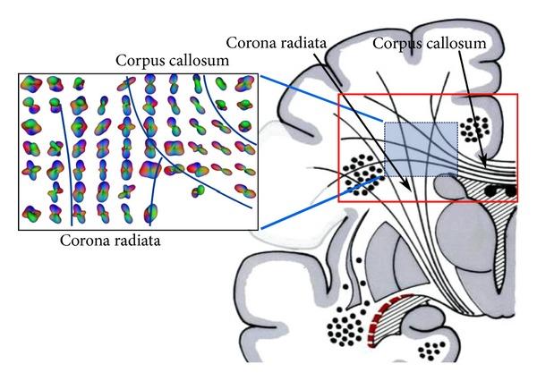 https://cdn.ncbi.nlm.nih.gov/pmc/blobs/128e/3608261/d55c484e1ef6/IJBI2013-658583.002.jpg