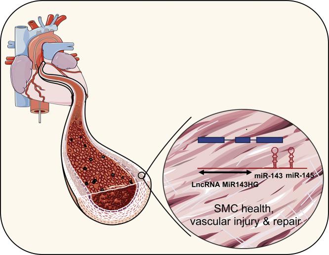 https://cdn.ncbi.nlm.nih.gov/pmc/blobs/1291/6395947/a74279a2c80a/ga1.jpg