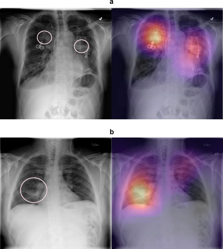 https://cdn.ncbi.nlm.nih.gov/pmc/blobs/1295/6245676/59cec7ab01fb/pmed.1002686.g003.jpg
