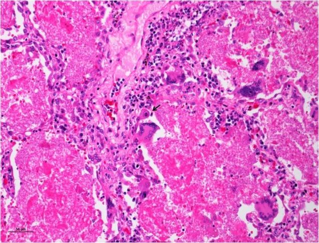 https://cdn.ncbi.nlm.nih.gov/pmc/blobs/129c/6287276/6021088dd751/autopsy-08-02e2018028-g03.jpg