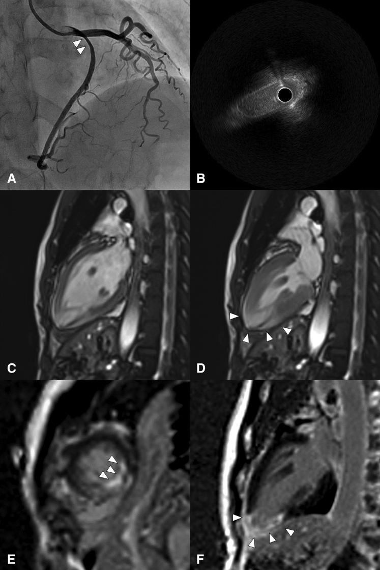 https://cdn.ncbi.nlm.nih.gov/pmc/blobs/129d/11145383/64a61d9e9f63/gr1.jpg