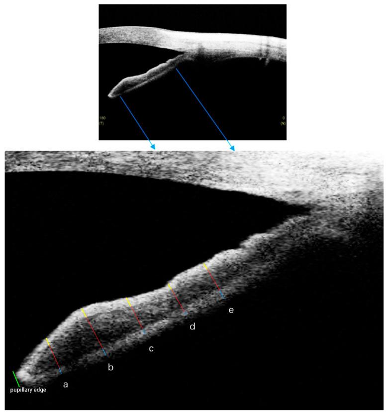 https://cdn.ncbi.nlm.nih.gov/pmc/blobs/12a0/9655842/6793d049e879/jcm-11-06484-g001.jpg