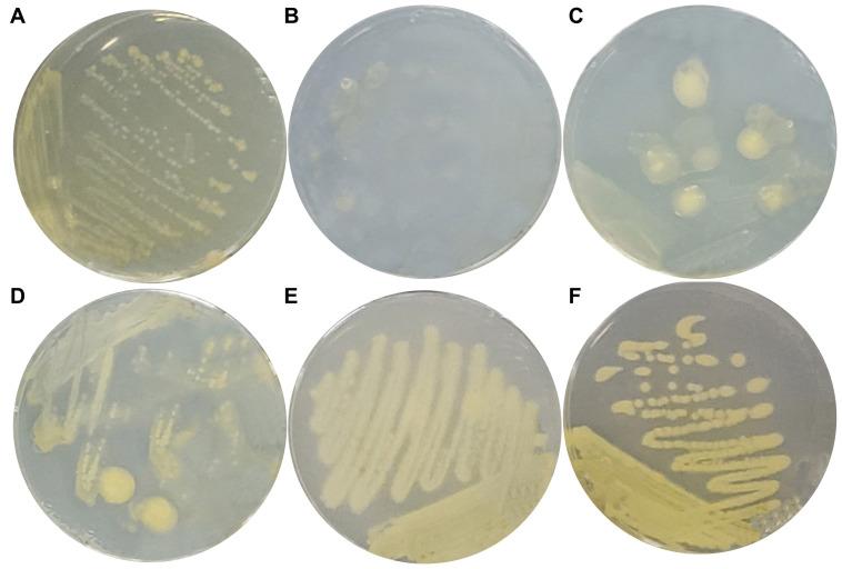 https://cdn.ncbi.nlm.nih.gov/pmc/blobs/12a3/10532344/df7a5f4092a1/ijms-24-14282-g001.jpg