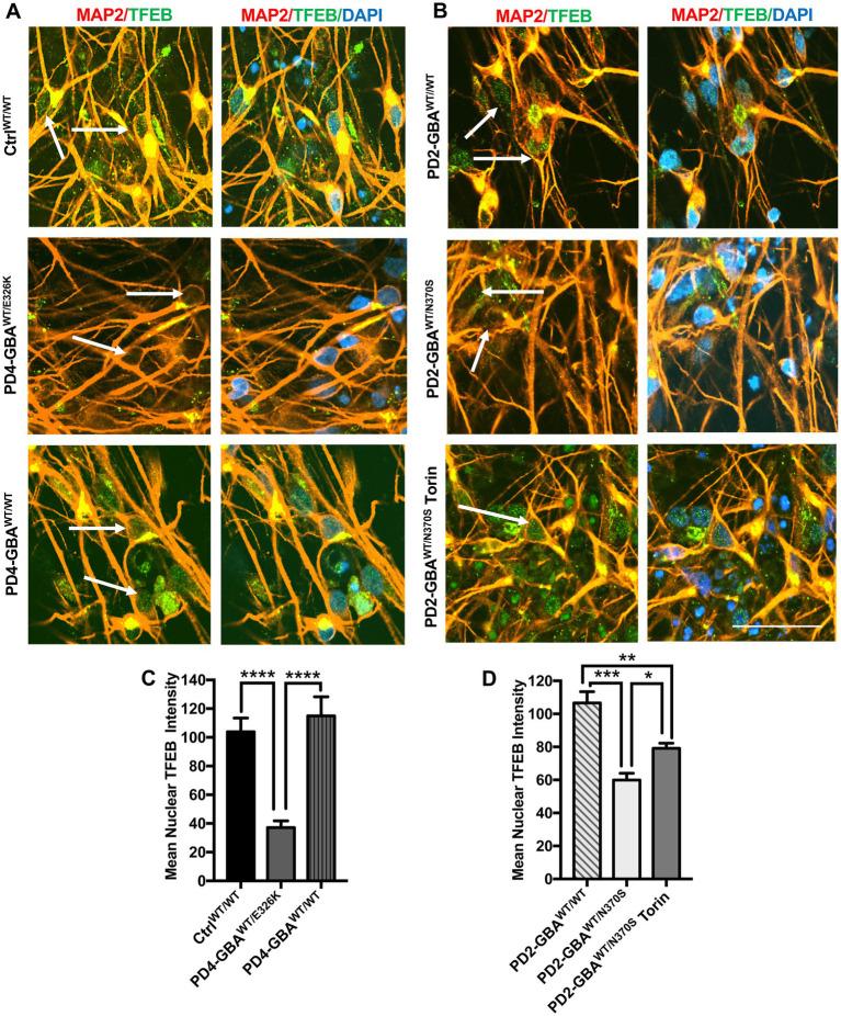 https://cdn.ncbi.nlm.nih.gov/pmc/blobs/12a7/10272450/3fdb0b95aba1/fnins-17-1152503-g004.jpg