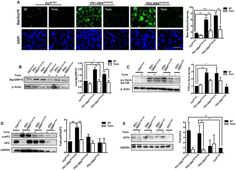 https://cdn.ncbi.nlm.nih.gov/pmc/blobs/12a7/10272450/4d077f2c1cf9/fnins-17-1152503-g007.jpg