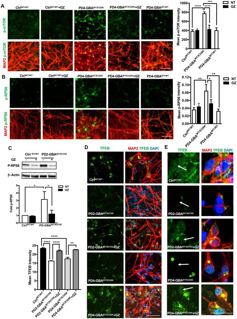 https://cdn.ncbi.nlm.nih.gov/pmc/blobs/12a7/10272450/a7173e4b57c0/fnins-17-1152503-g008.jpg