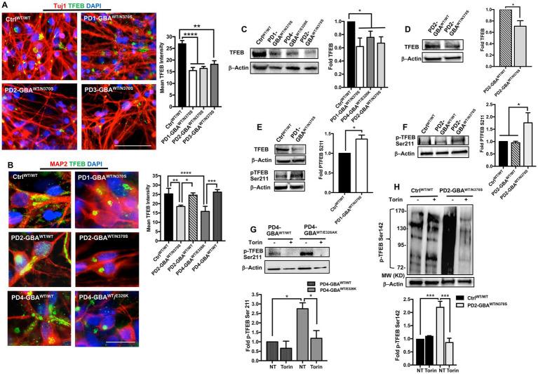 https://cdn.ncbi.nlm.nih.gov/pmc/blobs/12a7/10272450/a8c4886dd690/fnins-17-1152503-g003.jpg
