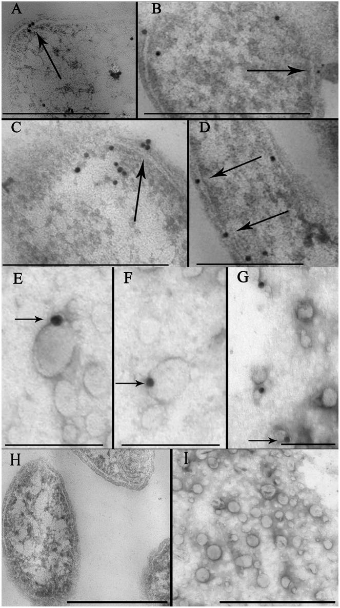 https://cdn.ncbi.nlm.nih.gov/pmc/blobs/12b1/5240029/27fe050f7aec/fcimb-07-00002-g0002.jpg