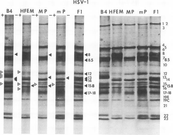 https://cdn.ncbi.nlm.nih.gov/pmc/blobs/12bc/355559/16404d55b5fc/jvirol00249-0252-a.jpg