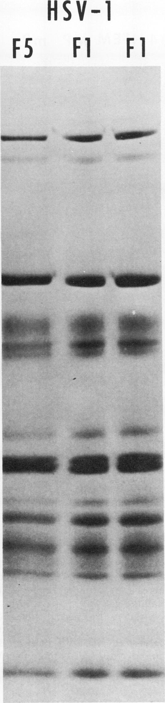 https://cdn.ncbi.nlm.nih.gov/pmc/blobs/12bc/355559/22b6802f818e/jvirol00249-0251-a.jpg