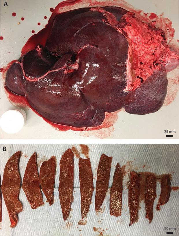 https://cdn.ncbi.nlm.nih.gov/pmc/blobs/12c0/6322137/41492b55ee27/10.1177_0963689718814188-fig2.jpg