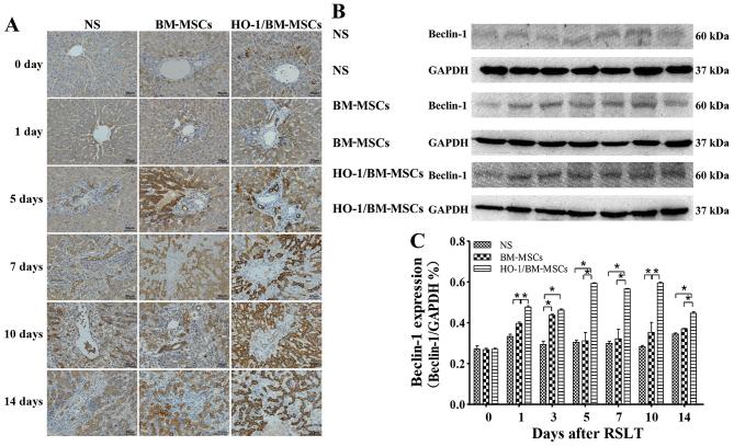 https://cdn.ncbi.nlm.nih.gov/pmc/blobs/12d4/5627878/3fea5e044edc/IJMM-40-05-1537-g05.jpg