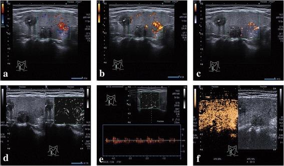 https://cdn.ncbi.nlm.nih.gov/pmc/blobs/12d4/5745911/cd8d65f1a069/12880_2017_241_Fig4_HTML.jpg