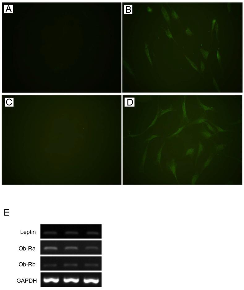 https://cdn.ncbi.nlm.nih.gov/pmc/blobs/12da/5859774/277463cc46fb/ijmsv15p0507g001.jpg