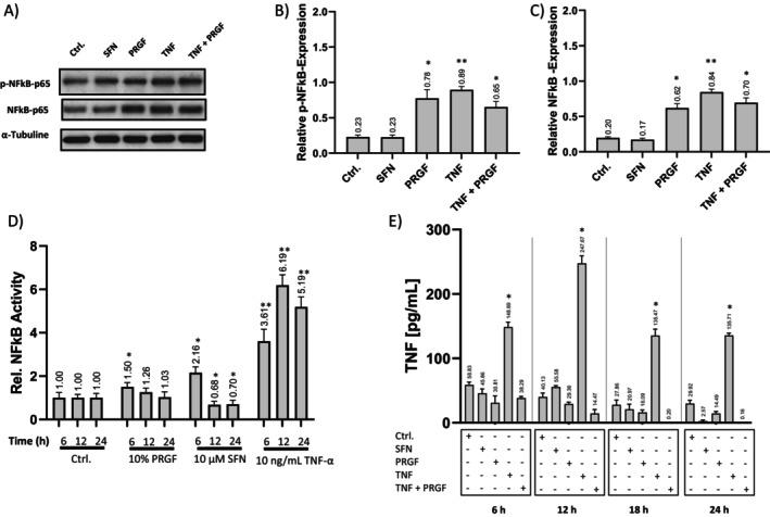 https://cdn.ncbi.nlm.nih.gov/pmc/blobs/12db/12067853/a36488d62590/JOCD-24-e70228-g005.jpg