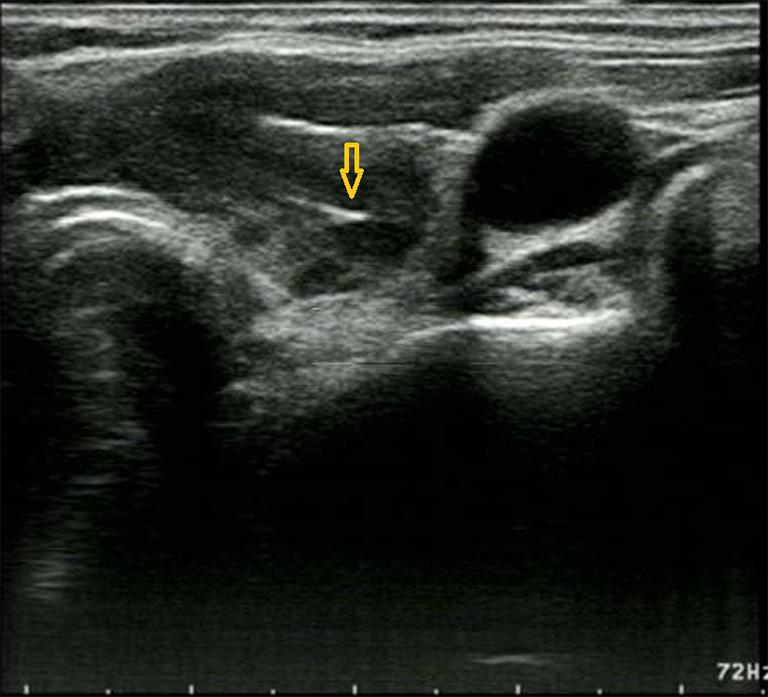https://cdn.ncbi.nlm.nih.gov/pmc/blobs/12f0/12261367/55cac28f7000/gs-14-06-1154-f2.jpg