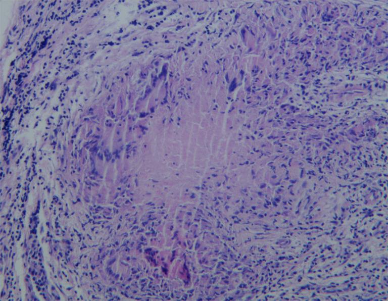 https://cdn.ncbi.nlm.nih.gov/pmc/blobs/12f0/12261367/8e60b7b651ca/gs-14-06-1154-f4.jpg
