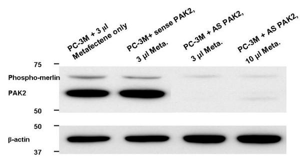 https://cdn.ncbi.nlm.nih.gov/pmc/blobs/12f4/2820461/1420b138a6f6/1471-2407-10-16-10.jpg