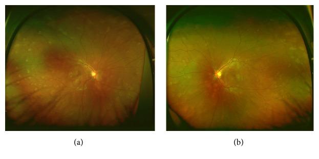 https://cdn.ncbi.nlm.nih.gov/pmc/blobs/12f4/6652076/02ad22814663/CRIOPM2019-9217656.001.jpg