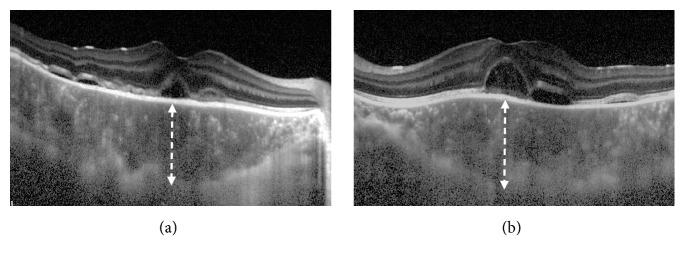 https://cdn.ncbi.nlm.nih.gov/pmc/blobs/12f4/6652076/e653042ebc1f/CRIOPM2019-9217656.002.jpg