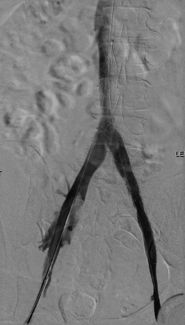 https://cdn.ncbi.nlm.nih.gov/pmc/blobs/12f6/10499663/e2d7b4188207/cureus-0015-00000043491-i03.jpg
