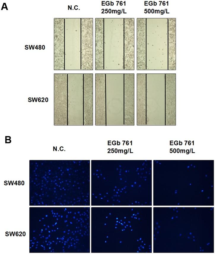 https://cdn.ncbi.nlm.nih.gov/pmc/blobs/12f6/5710951/2b76e607a989/oncotarget-08-91614-g001.jpg