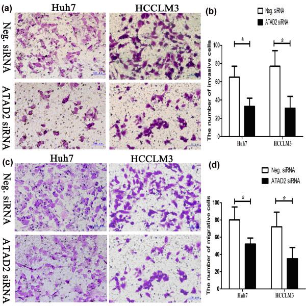 https://cdn.ncbi.nlm.nih.gov/pmc/blobs/12f8/4016509/9a565eacfe33/1471-2407-14-107-5.jpg