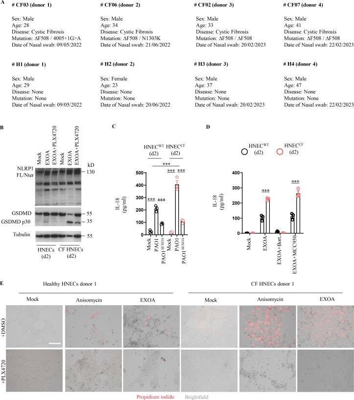 https://cdn.ncbi.nlm.nih.gov/pmc/blobs/12fd/10465324/a4cbec0dfb84/JEM_20230104_FigS3.jpg