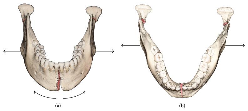 https://cdn.ncbi.nlm.nih.gov/pmc/blobs/1302/4663366/f928ceeebff4/SRP2015-569030.001.jpg