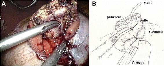 https://cdn.ncbi.nlm.nih.gov/pmc/blobs/1305/4487839/260319847e44/12893_2015_61_Fig5_HTML.jpg